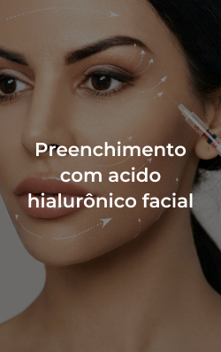 Preenchimento com ácido hialurônico facial