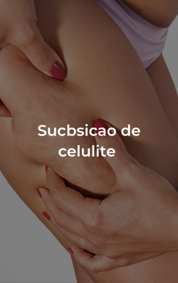 Subcisão de celulite