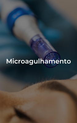 Microagulhamento