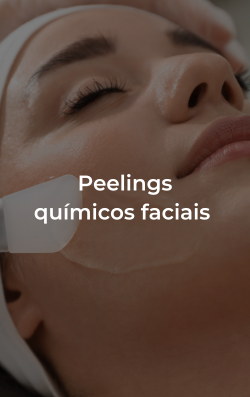 Peelings químicos faciais